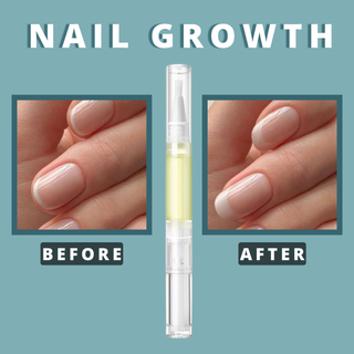 AMORIE - Nail Growth Oil for Strength and Moisture