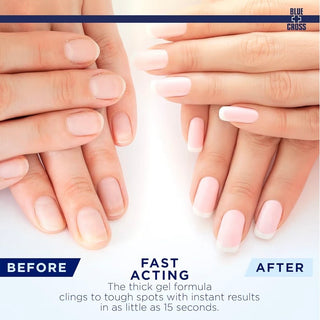 Blue Cross Cuticle Remover Gel